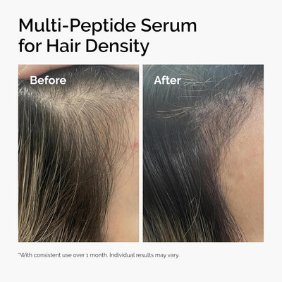 The Ordinary Multi-Peptide Hair Density Serum